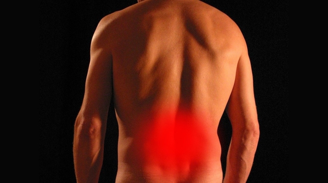 sciatica